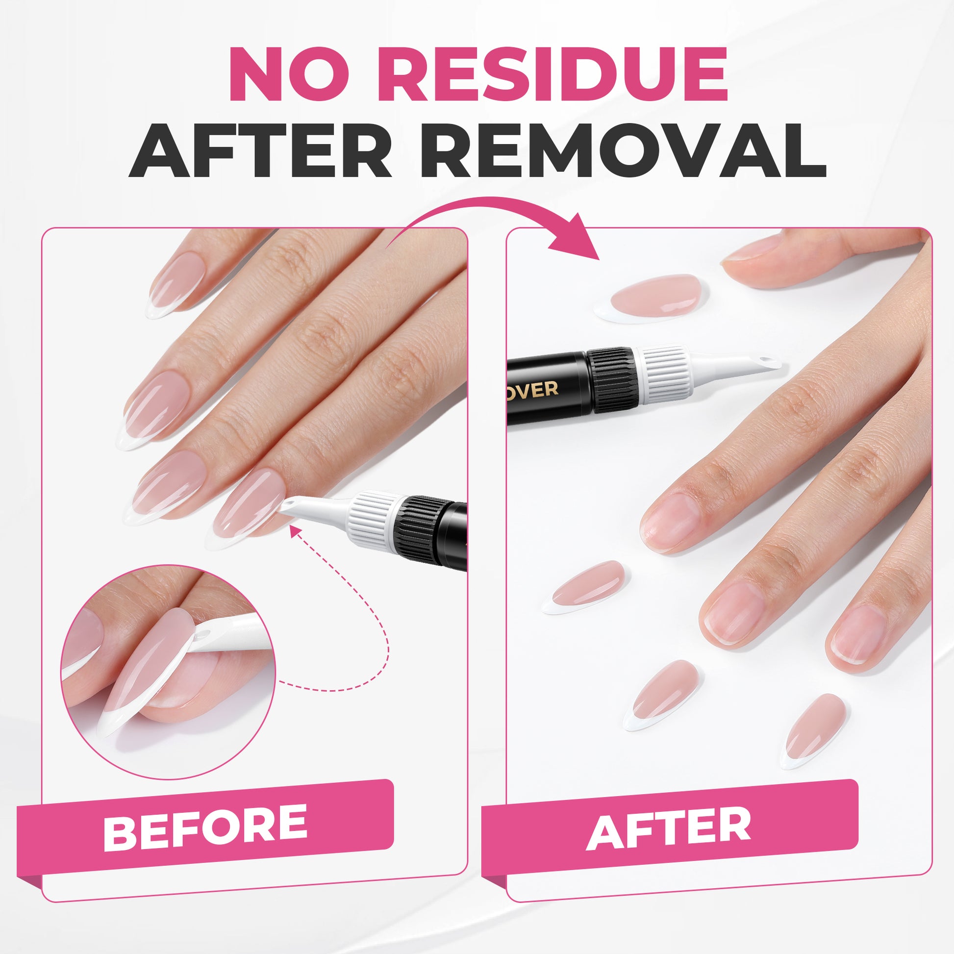 UNA GELLA 15g semi-solid nail glue and 10ml remover set with press-on nails kit for long-lasting, easy-to-apply manicures.